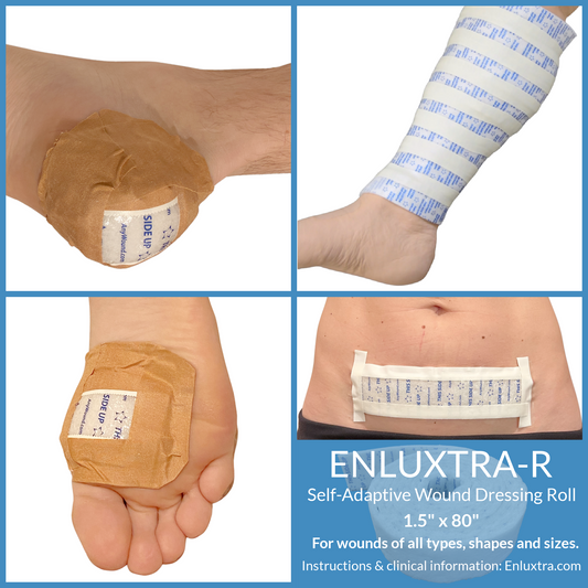 ENLUXTRA-R Wound Dressing Roll for Legs, Arms, Torso and Head 1.5" x 80"