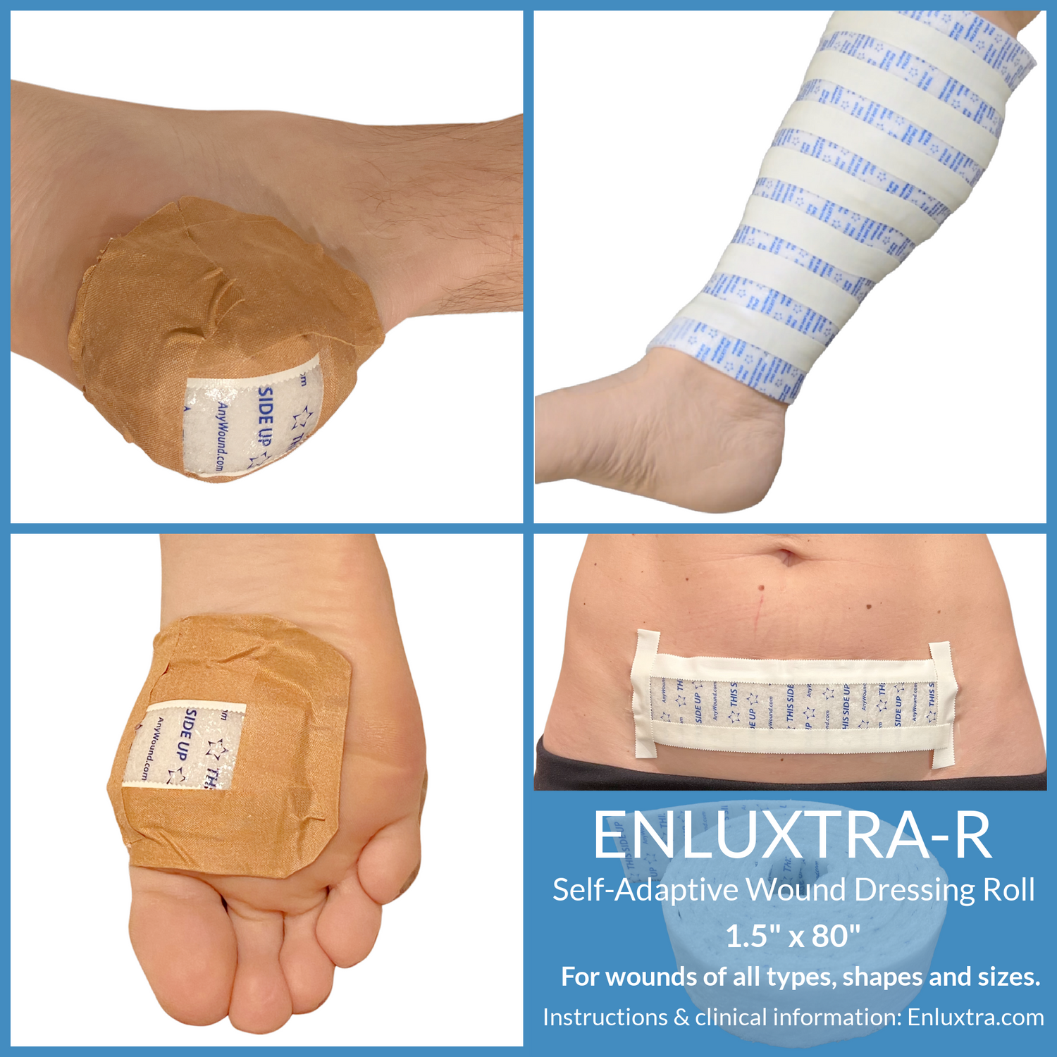 ENLUXTRA-R Wound Dressing Roll for Legs, Arms, Torso and Head 1.5